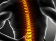 osteopathe marseille mal de dos